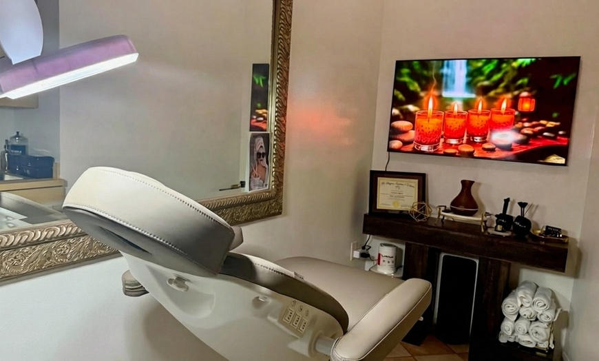 Image 3: One, Three or Five 60-Min Chemical Peel Facial Sessions for Skin Glow