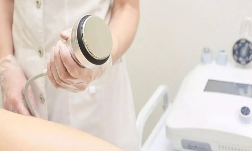 Image 5: Metamorfoza brzucha, nóg i pośladków z zabiegami Endosfera, EMS i EMT