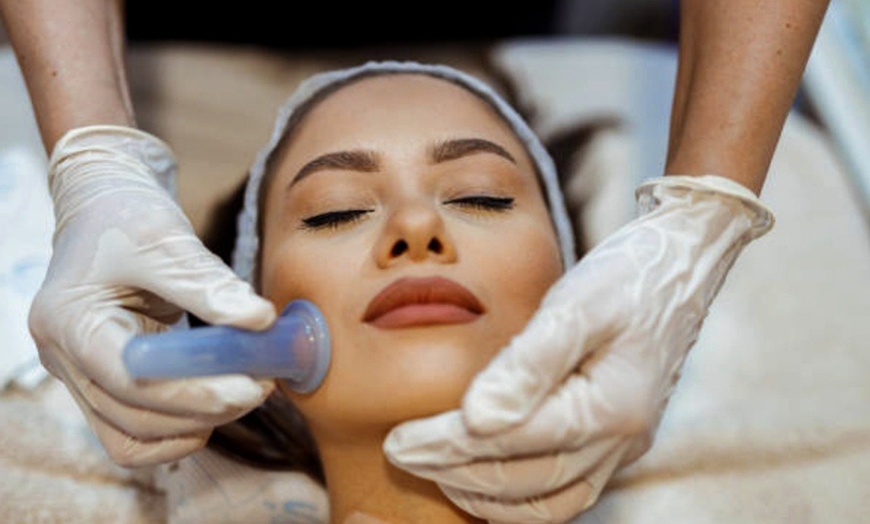 Image 5: Up to 45% Off on Facelift - Non-Surgical at Violet Wellness Spa by Tian Chao Herbs and Acupuncture