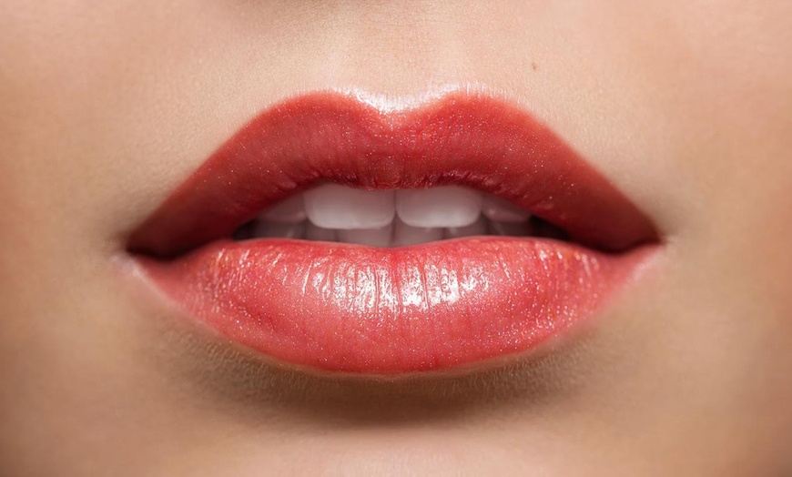 Image 4: Lip Laser Rejuvenation with/wihtout Hyaluronic Acid Filler Options