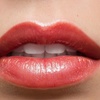 Image 4: Lip Laser Rejuvenation with/wihtout Hyaluronic Acid Filler Options