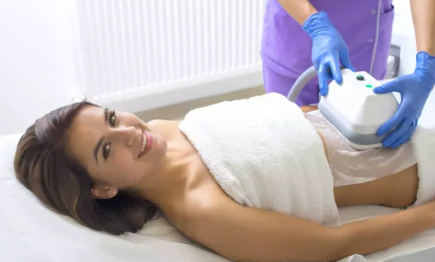 Image 1: Séance de cryolipolyse d'1h chez Bronz Et Zen