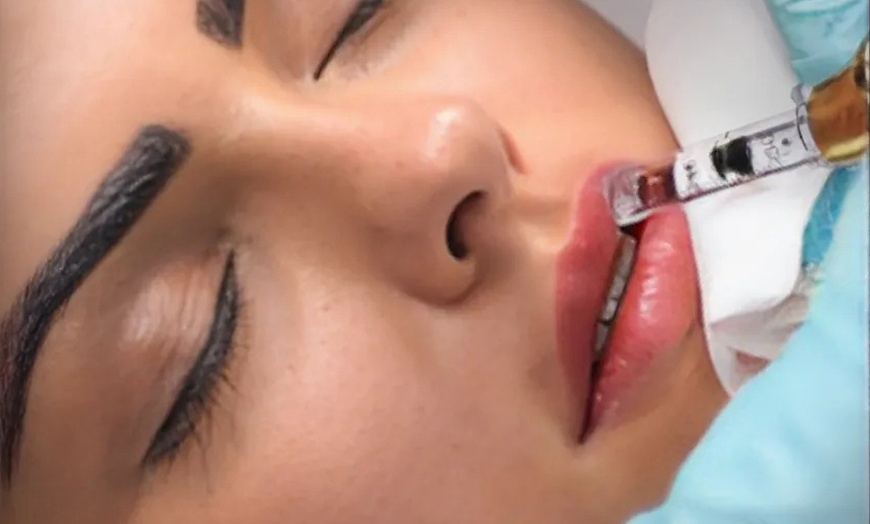 Image 15: Hyaluronpen con hidratación o relleno de labios y reafirmación facial