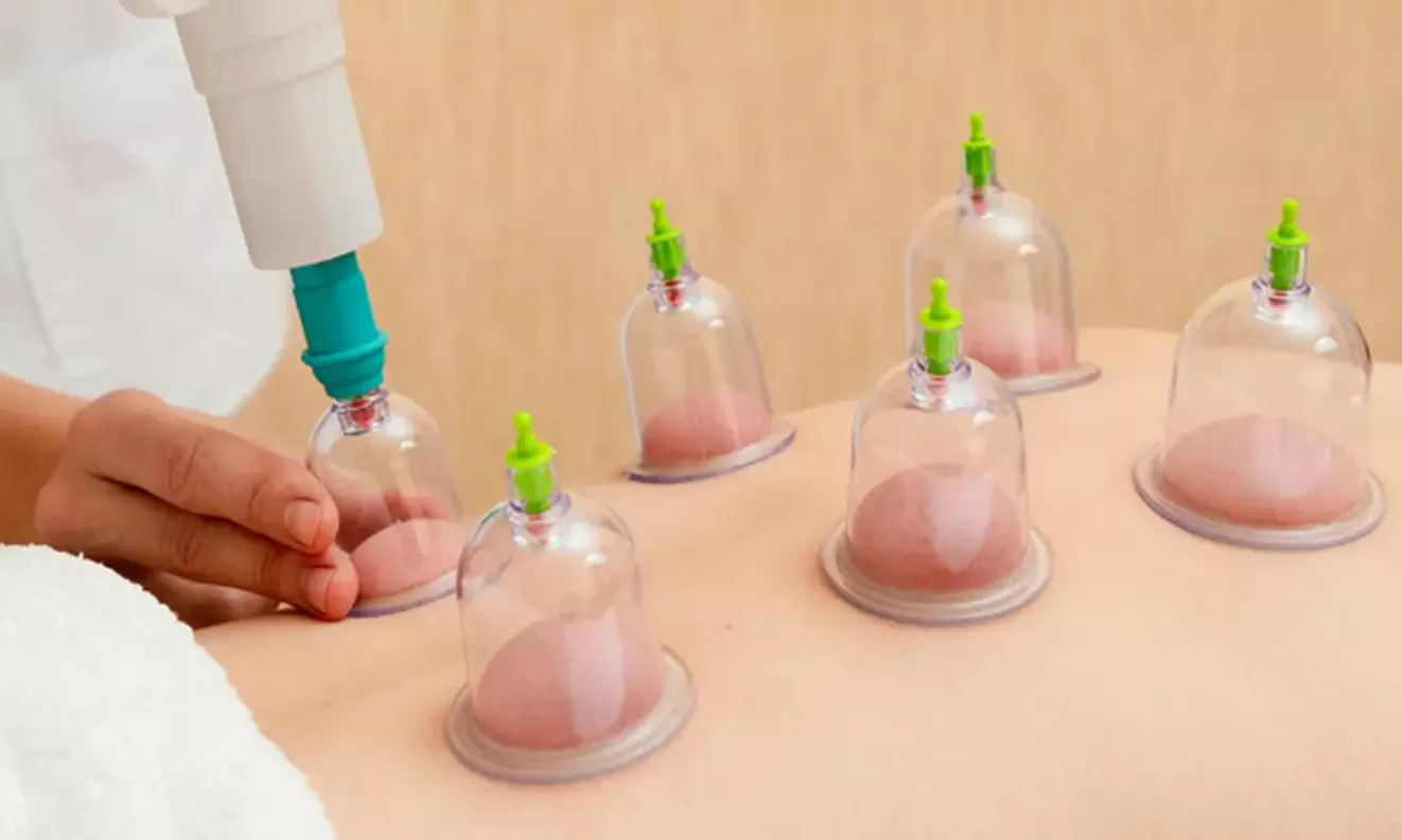 Cranial Therapy, Deep Tissue Massage, Myofascial Cupping & Consult