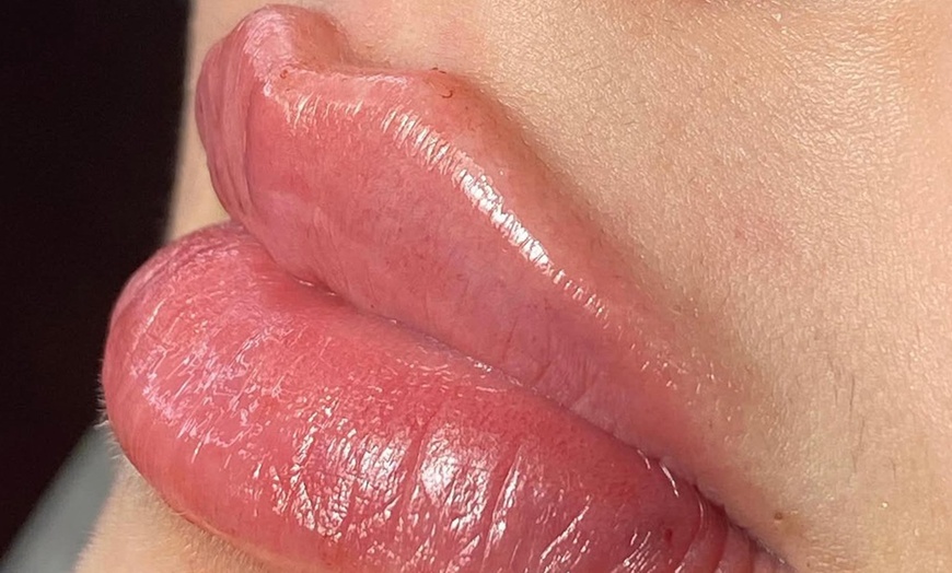 Image 3: Smooth, Plump & Perfect: Versa Enhancements at Divaa Beauty