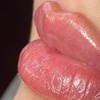 Image 3: Smooth, Plump & Perfect: Versa Enhancements at Divaa Beauty