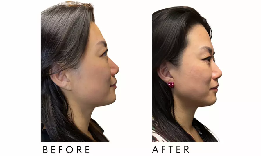 Up to 46% Off on Electrical Muscle Stimulation at Your Sculpt Studio