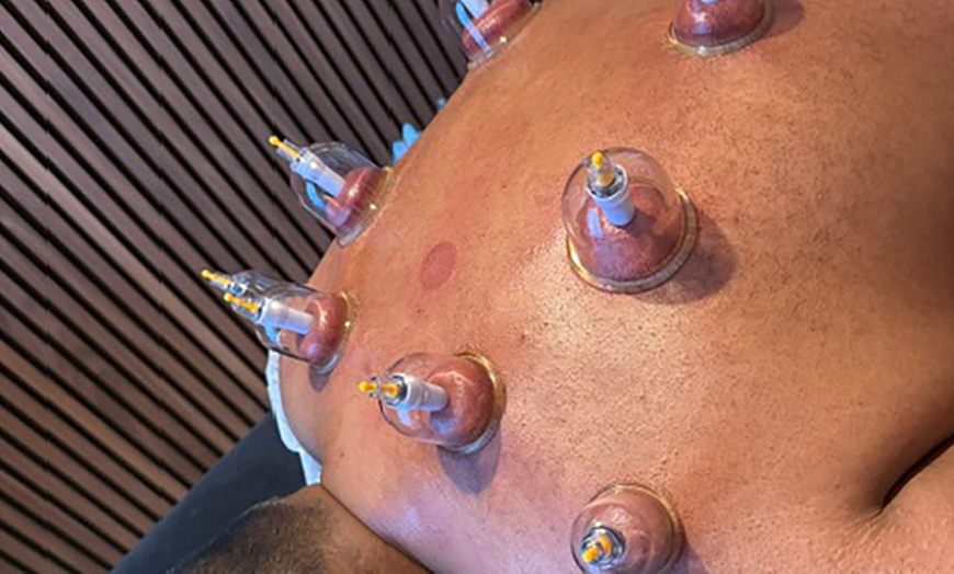 Image 12: Diepe ontspanning en balans met massage en cupping sessies