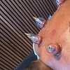 Image 12: Diepe ontspanning en balans met massage en cupping sessies