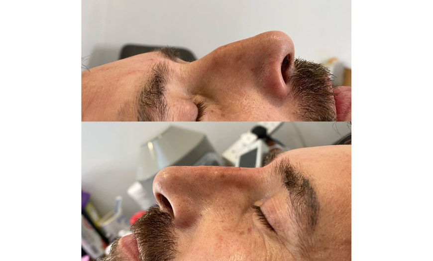 Image 3: Get Smooth Skin with 1, 2, or 3 Dark Circle / Under Eye Treatments