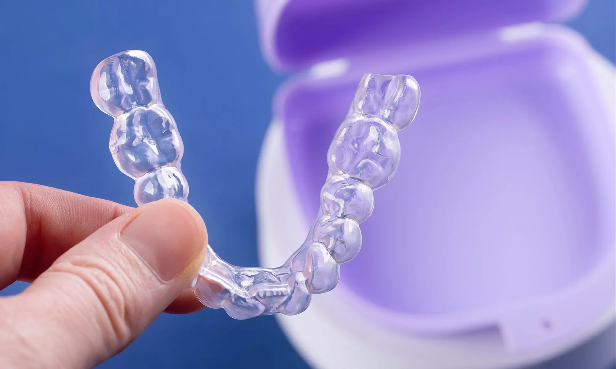 Get All-Inclusive Clear Aligners with Free Whitening Kit