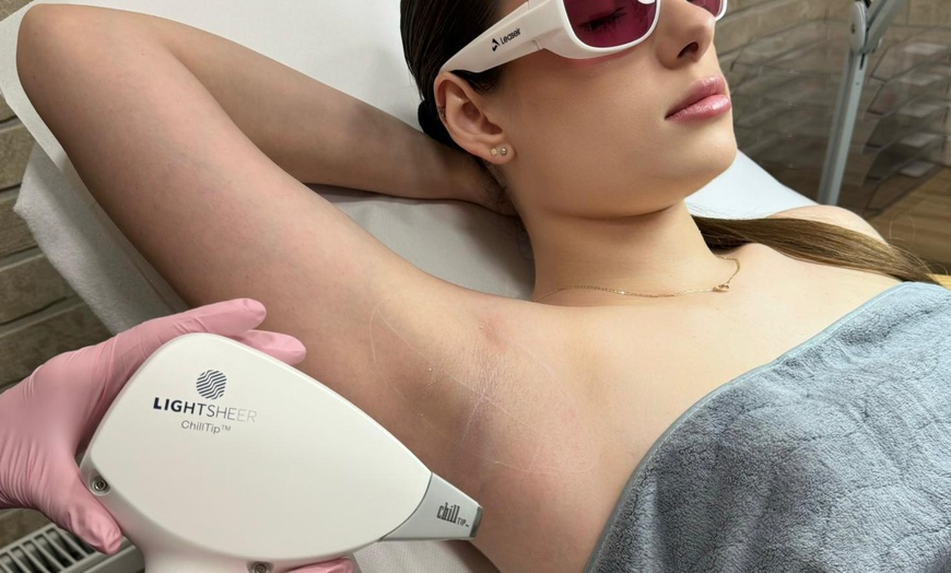 Image 4: Depilacja laserowa: pojedyncze zabiegi lub pakiet roczny