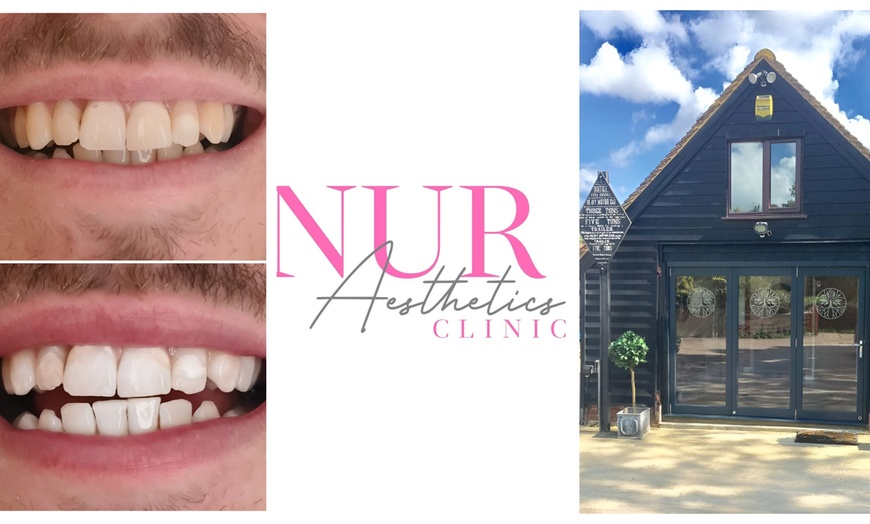 Image 2: 1 or 2 Sessions of 60-Minute Laser Teeth Whitening