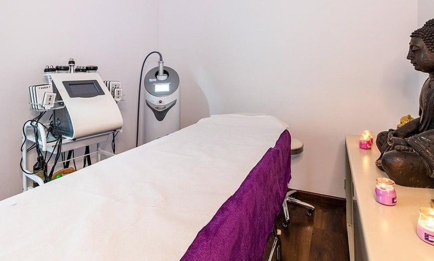 Image 3: 1 o 2 sesiones de Dermapen con relleno dérmico y vitaminas 