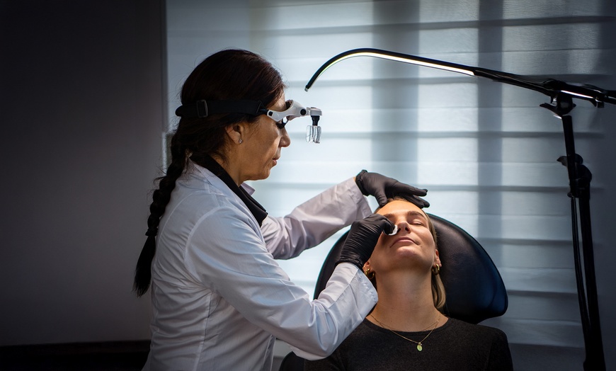 Image 1: Luxe Belotero Balance fillers met consultt voor een frisse uitstraling