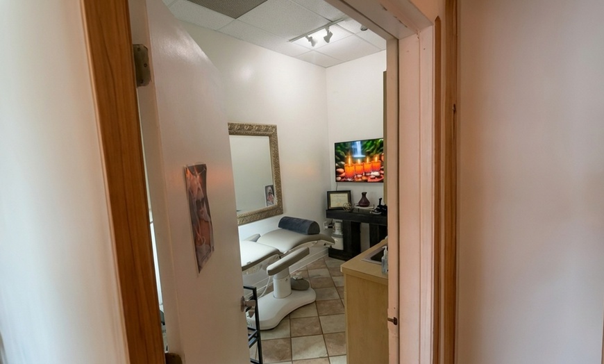 Image 13: One, Three or Five Microdermabrasion Facial Sessions for Smoother Skin