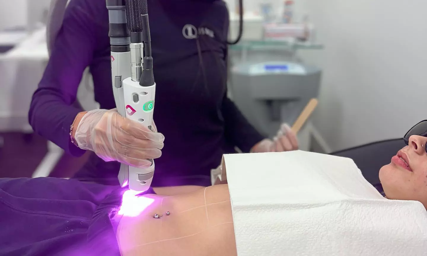 Six Laser Hair Removal Sessions on Your Choice of Area at Jes Laser Aesthetics (Up To 60% Off) - Second Medium