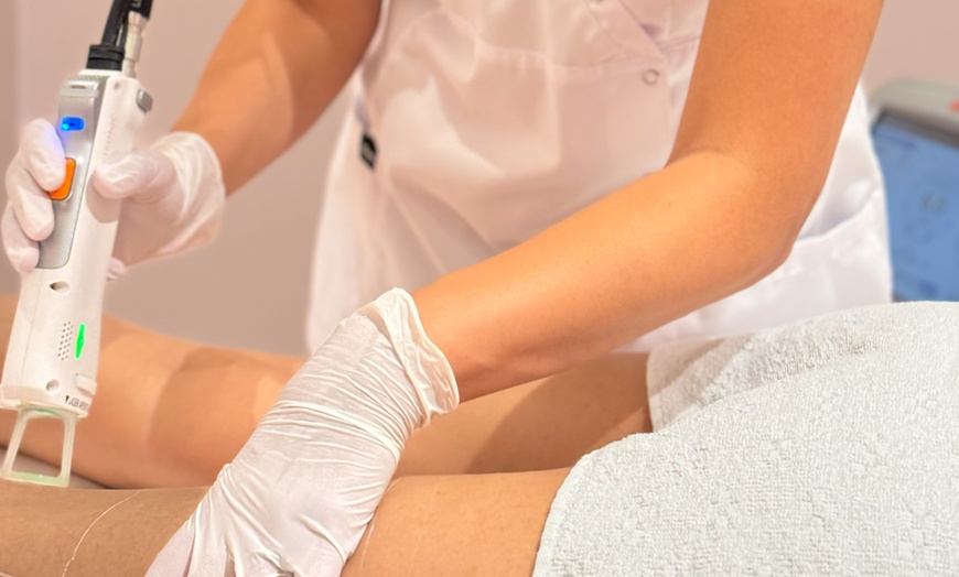 Image 2: 3 - 5 Laser-Haarentfernungen an einer kleinen Zone für 1 Person