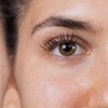 Image 2: Reveal Brighter, Younger-Looking Eyes with Eyelid Surgery