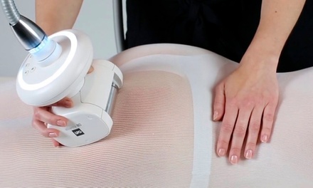 2 sesiones de endomasaje reductor y anticelulítico en una zona a elegir - Cosma