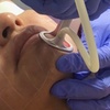 Image 2: Up to 61% Off on Laser Skin Resurfacing at Fiori di Lino MedSpa