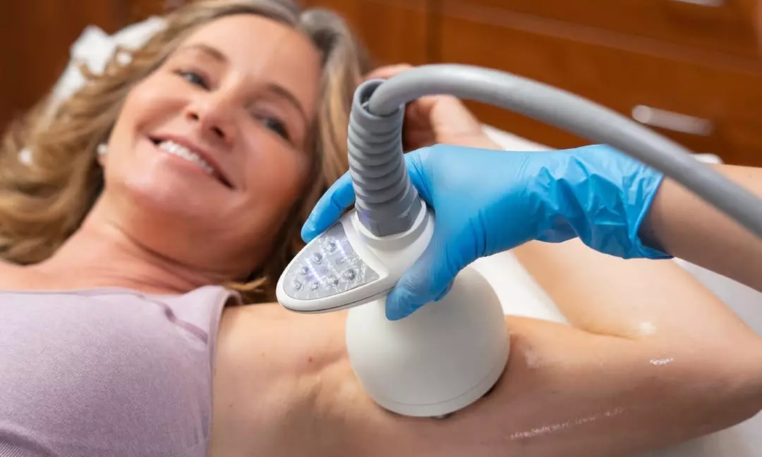 One or Three Laser Skin Tightening Sessions for Face Neck & Body Areas