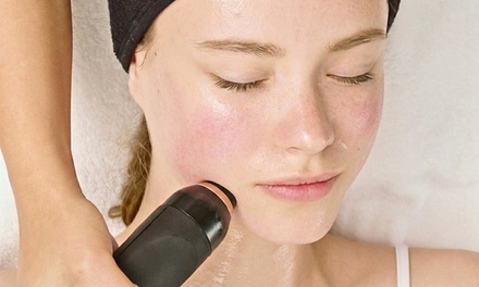 One session of RF Skin Tightening By Geneo X | Full Face and Neck - Skin Ethos