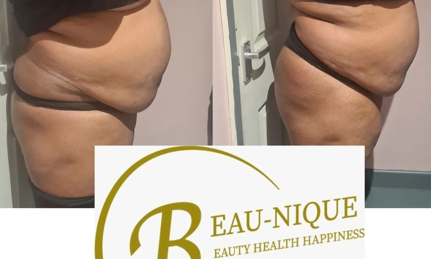 Image 3: Expert Body Sculpting with Laser Lipo, Cavitation or Radiofrequency