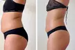1–3 Deluxe 90-Min Lymphatic Drainage & Body Sculpt Sessions at Bare fruit Body Lab(Up To 62% Off) - Second Medium