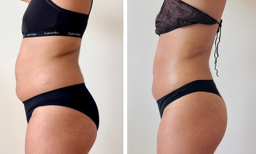 Image 4: Deluxe Lymphatic Drainage & Body Sculpt Sessions