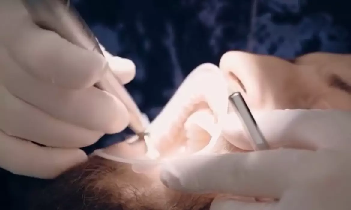 Dental Exam, Teeth Whitening, Membership, X-ray/Implant Package & More
