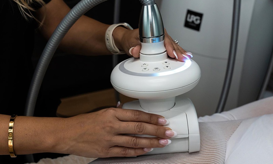 Image 6: 1, 2 o 5 sesiones de tratamiento reductor con Indiba para 1 persona 