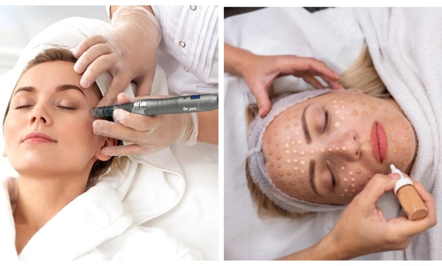 Image 1: Microneedling for Face & Neck or BB Glow Facial with Microneedling