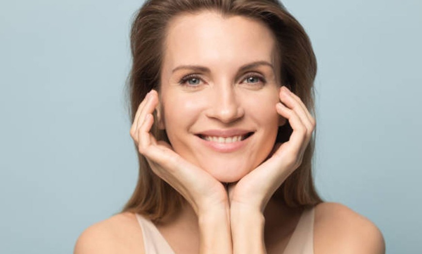 Image 11: Exosomas con Dermapen en rostro completo, una o dos sesiones