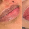 Image 5: Perfect Lips: Semi-Permanent Blush, Lip Liner & Dark Lip Correction