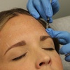 Image 3: Up to 37% Off on Injection Dysport at Total Med Solutions