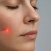 Image 1: Endolift Laser Lift and Chin Contouring and Manual Fat Removal