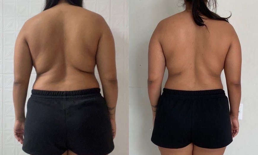 Image 1: Up to 59% Off on Cavitation at Beauty Factory Boutique Spa