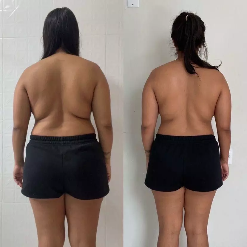 Up to 59% Off on Cavitation at Beauty Factory Boutique Spa - Primary Image