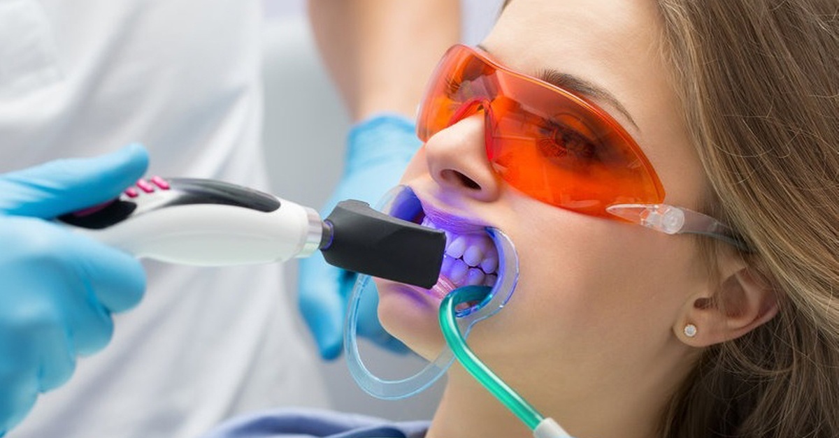 Servicio de higiene bucal y blanqueamiento dental en Madrid