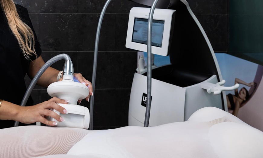 Image 7: 1, 2 o 5 sesiones de Indiba facial efecto rejuvenecimiento para 1 