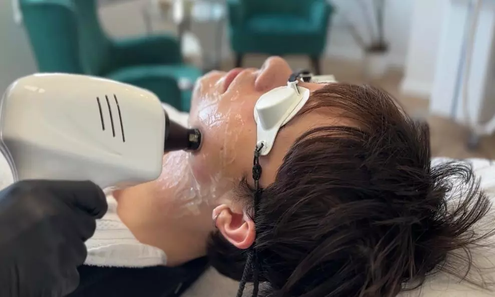 Depilacja laserowa wybranej partii ciała – 1 lub 3 zabiegi