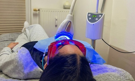 Kosmetisches Zahnbleaching: 1 Durchgang á 15 Min. für 1 Person - Viktoria Cosmetic Studio