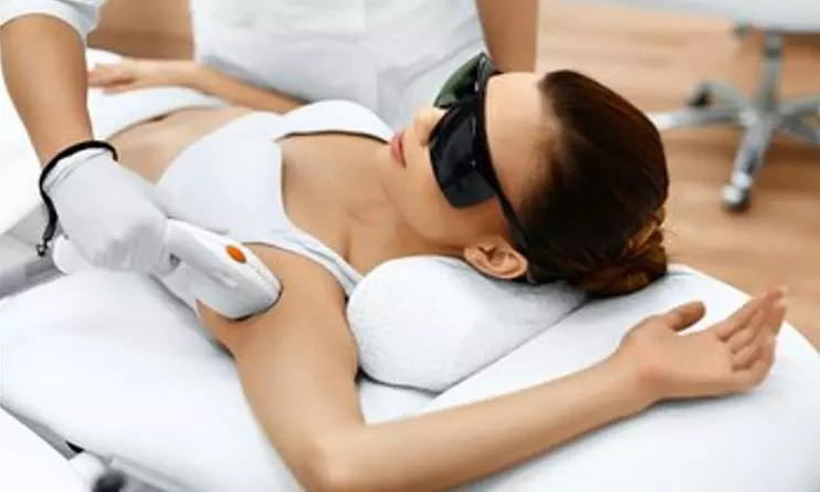 5 séances épilation laser sur une zone petite, moyenne ou grande