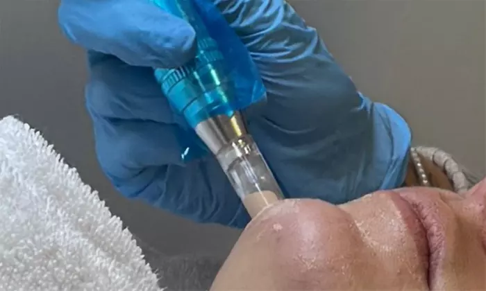 Entspannung für die Haut: Gesichtsbehandlung nach Wahl für 1 Person