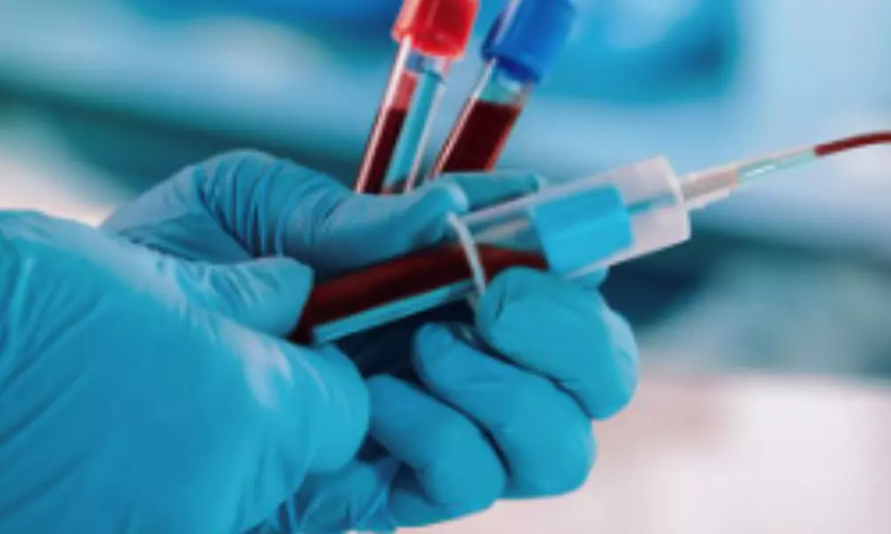 Energy and Vitality Testing, Wellness Testing or Male or Female Comprehensive Hormone Testing ( Up to 3% Off ) - Primary Image