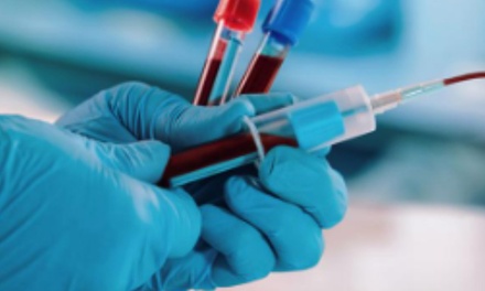 Energy and Vitality Testing - Tranquilicare