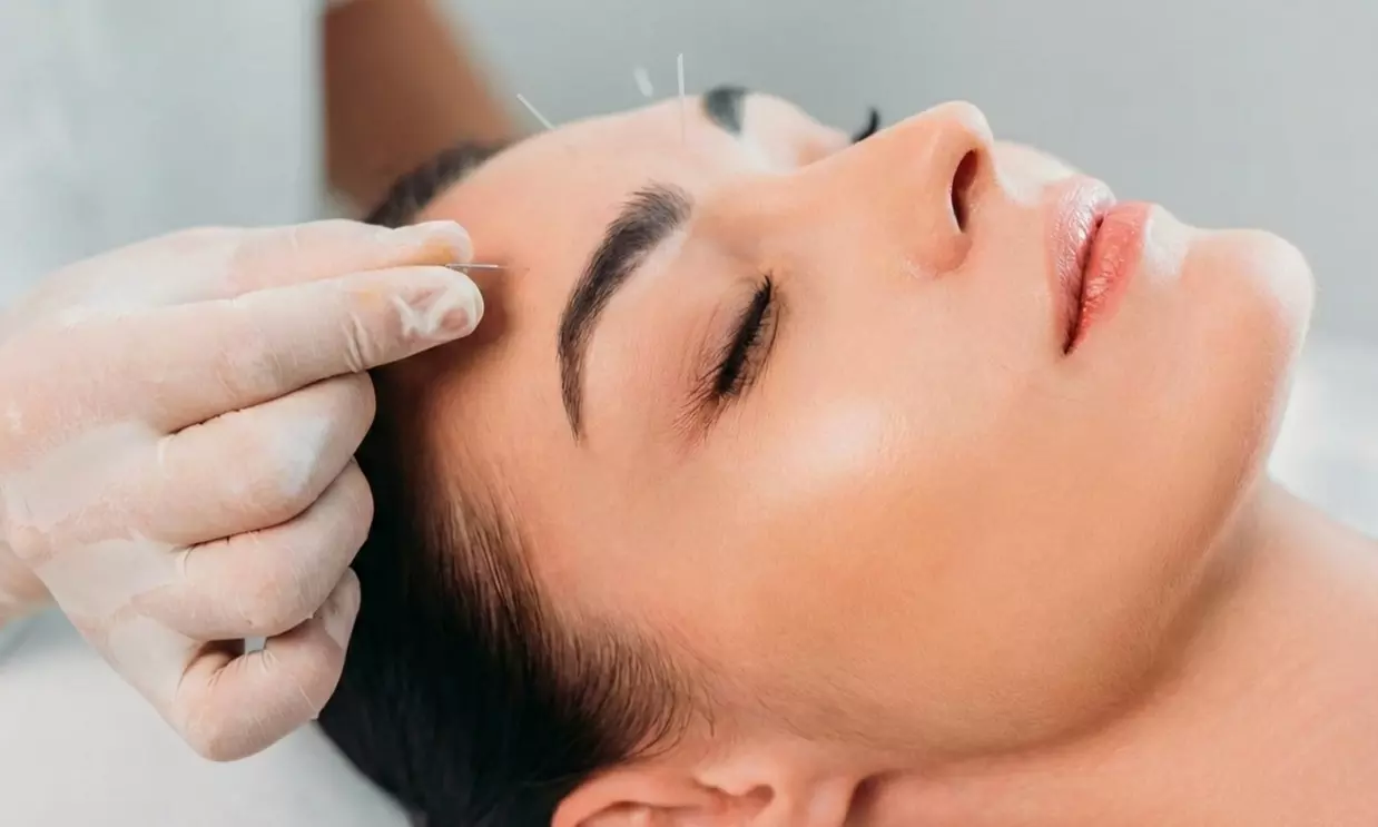 Tratamiento facial con oxigenoterapia, acupuntura y velo de colágeno