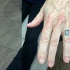 Image 2: 3 Laser Tattoo Removal Sessions: Small, Medium, Large or XL Areas