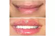 Smooth, Plump, & Perfect: Versa Enhancements at Divaa Beauty (Up to 40% Off) - Second Medium
